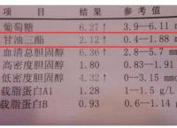 关于TG高于多少称为高血脂的信息