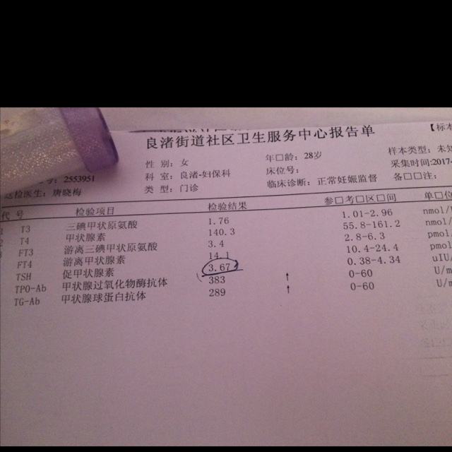[TG与TGAb]tg与tan的区别