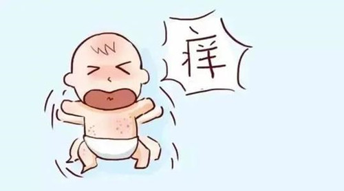 去除婴儿热疹小妙招-小孩湿疹反反复复怎么根除