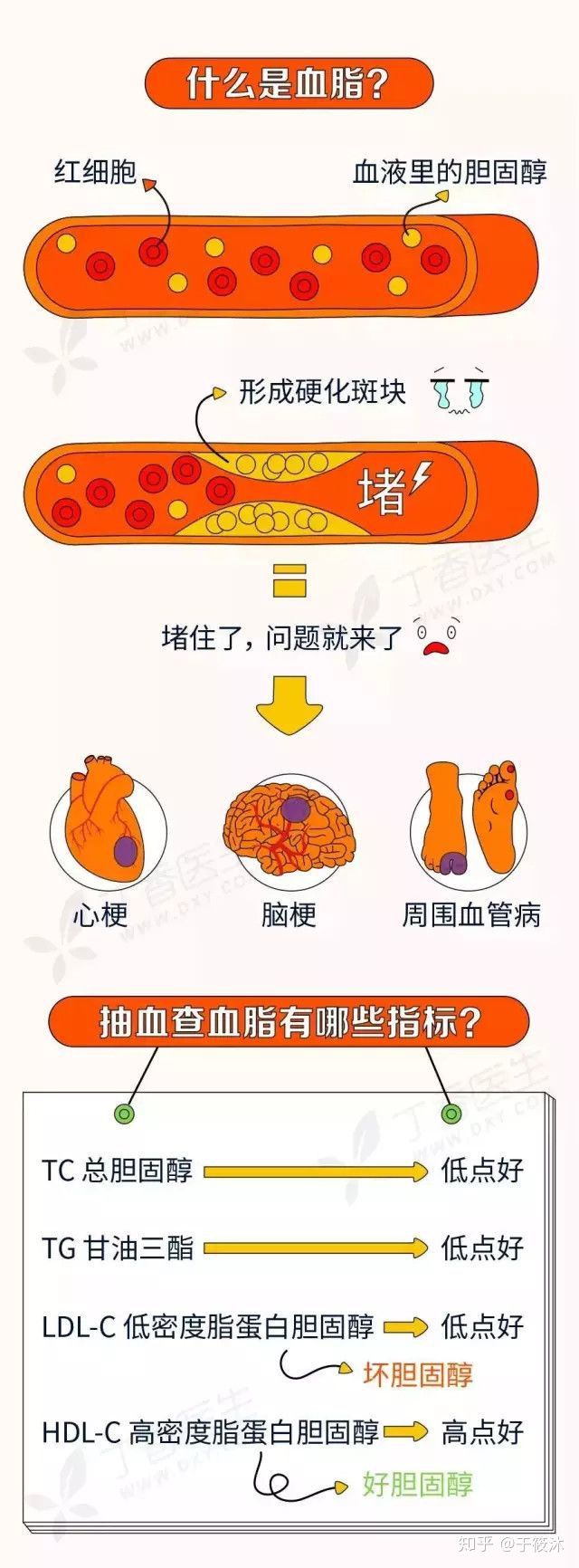 关于TG高于多少称为高血脂的信息