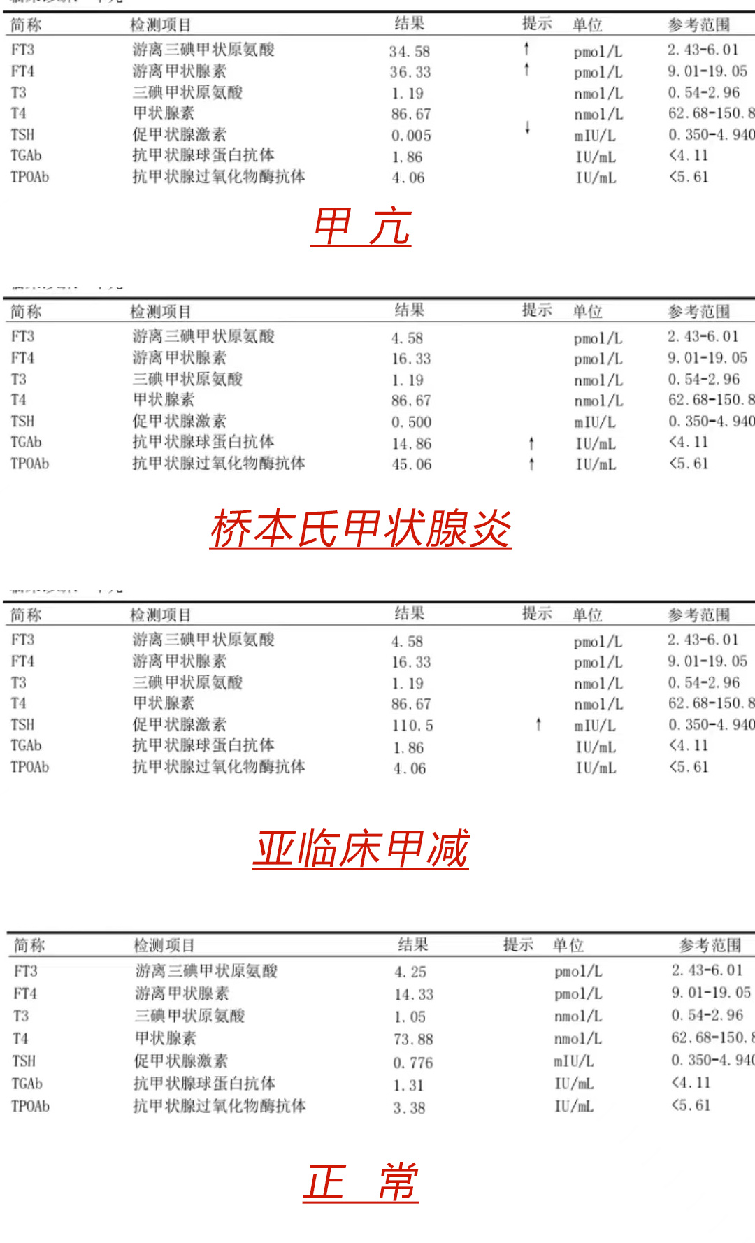 Tpo和TG升高,tpo升高有什么意义