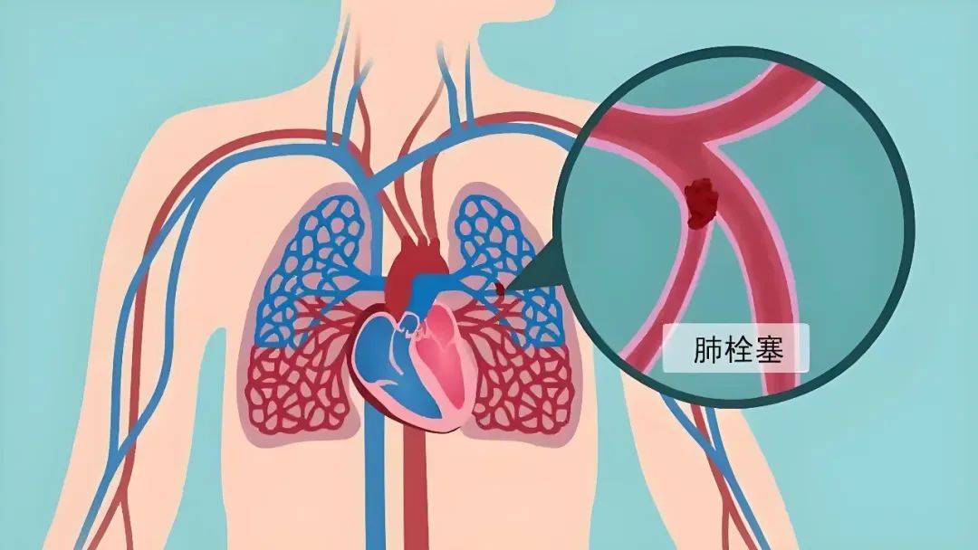 cta动画制作,cta动画制作软件手机版